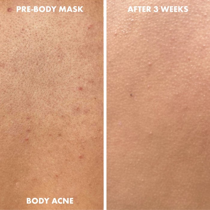 Pink Soufflé Body Mask With Niacinamide, Kaolin Clay, Dragon Fruit & Coconut Oil