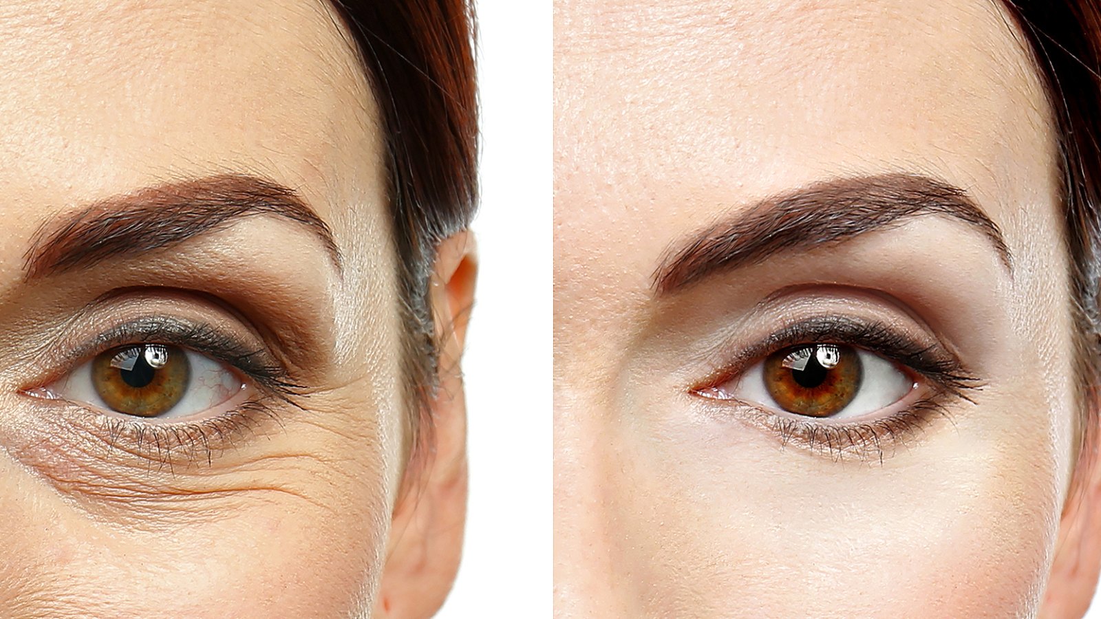 caffeinated-eye-cream-wrinkle-before-after