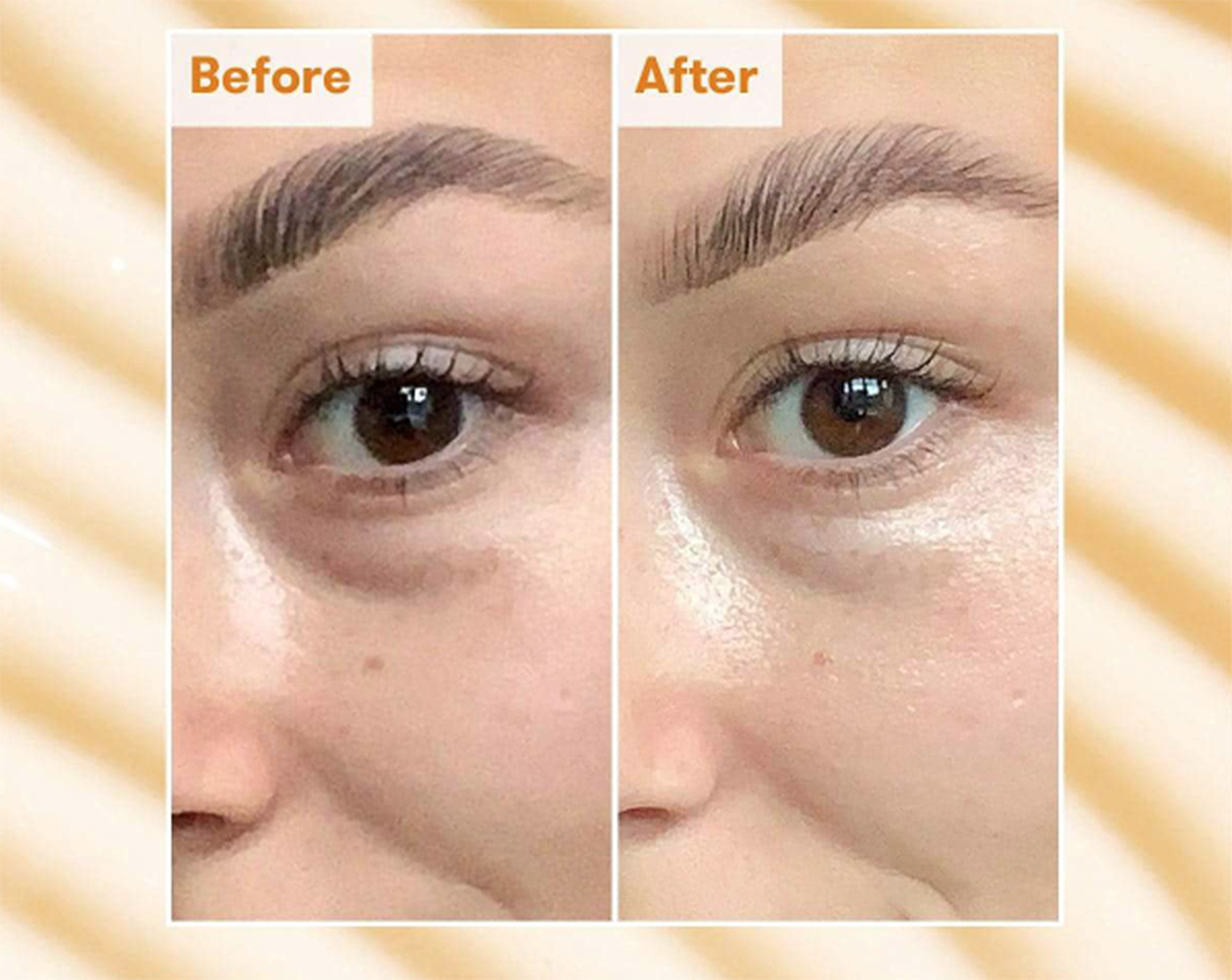 REN Eye Cream Could Visibly Reduce Dark Circles in Just 7 Days