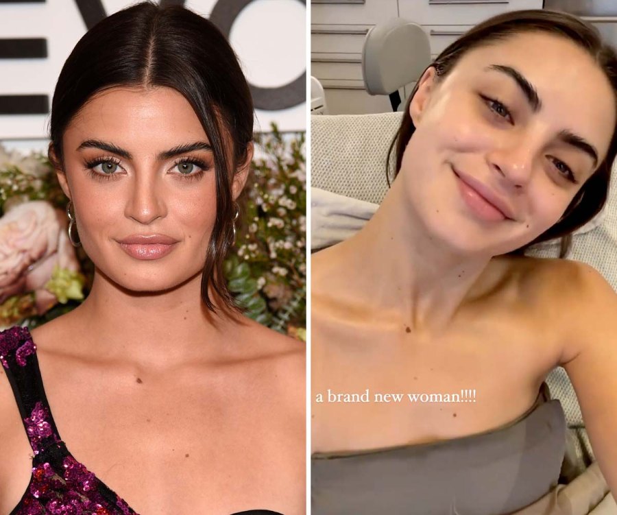 Bachelors Rachael Kirkconnells Post Facial Glow Is Unmatched New Woman