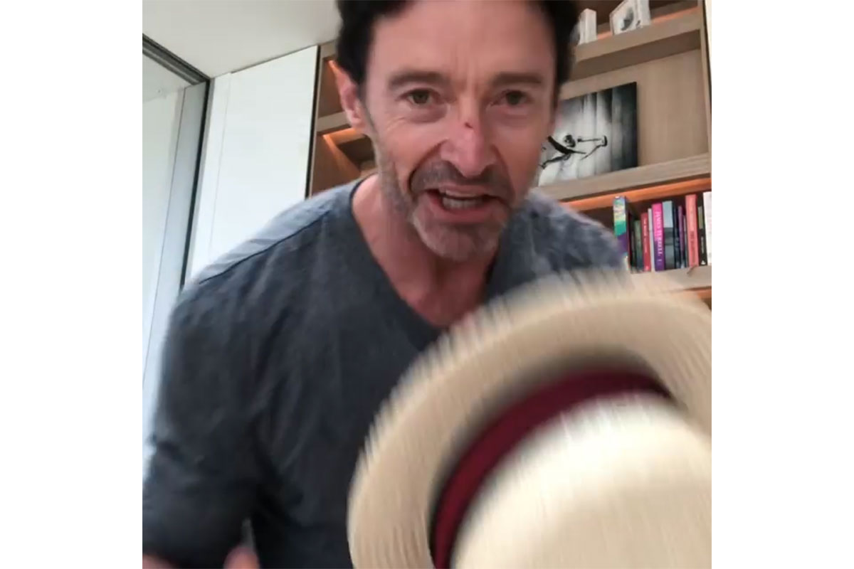 Hugh Jackman Sliced His Nose With Music Man Hat