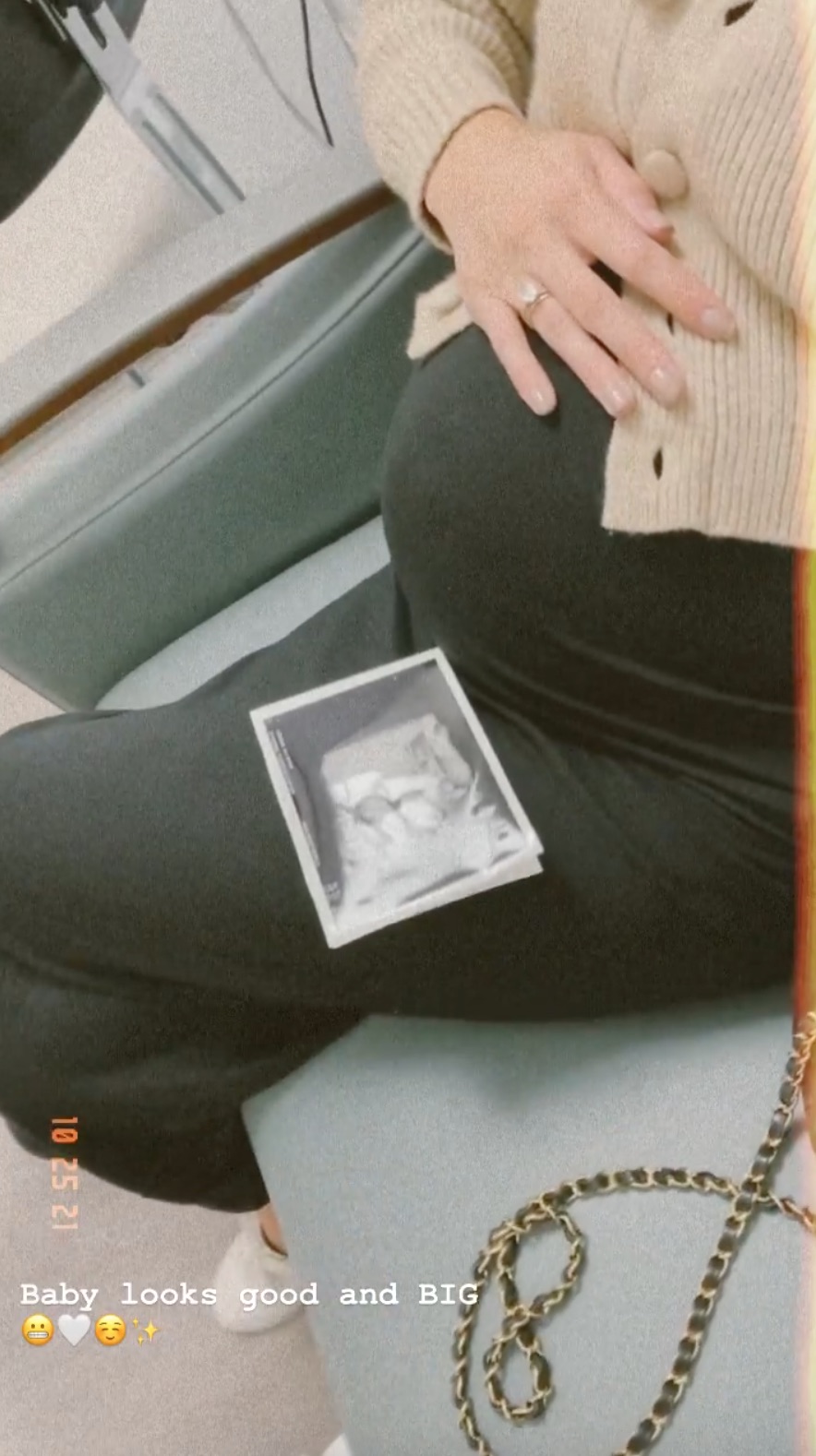 Model Lindsay Ellingson and More Pregnant Stars Share Ultrasound Pics
