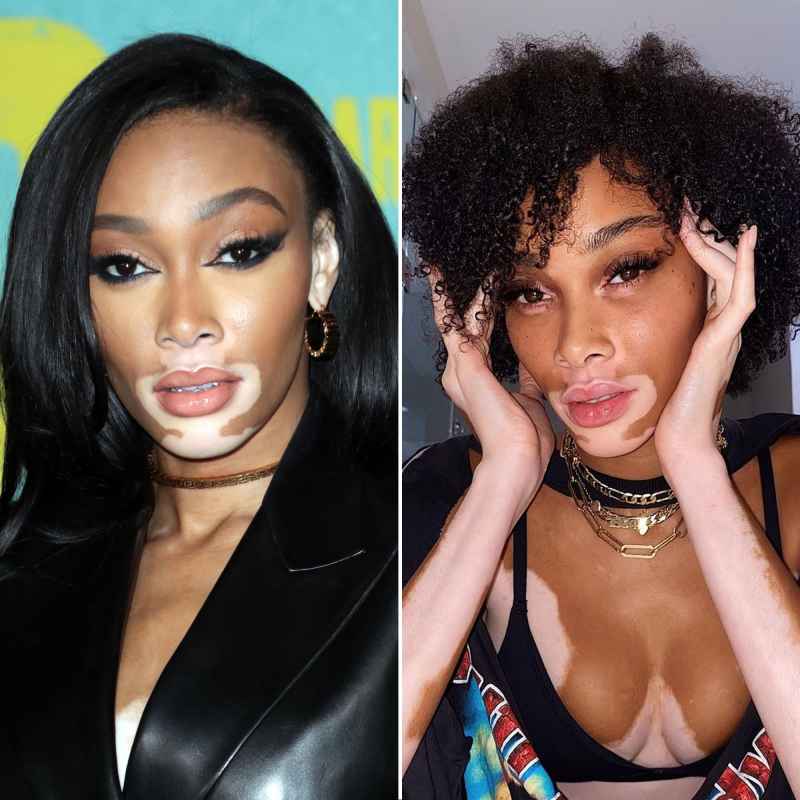 Winnie Harlow Most Stunning Celebrity Makeup-Free Moments of 2021