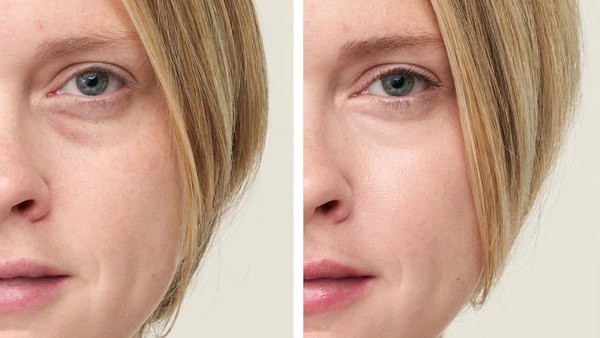 jane-iredale-concealer-before-after