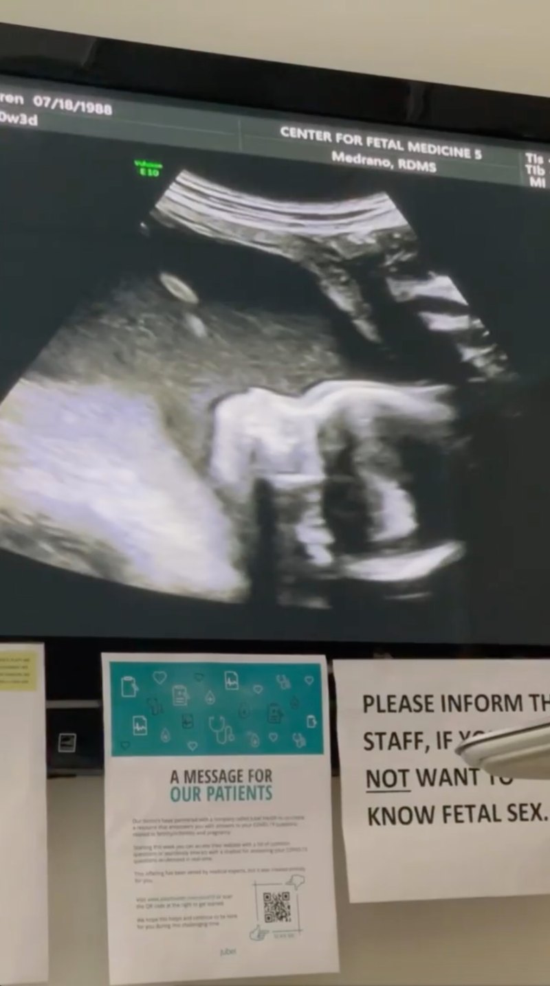 20 Weeks! Jason Kennedy and Pregnant Lauren Scruggs Show Ultrasound Pics