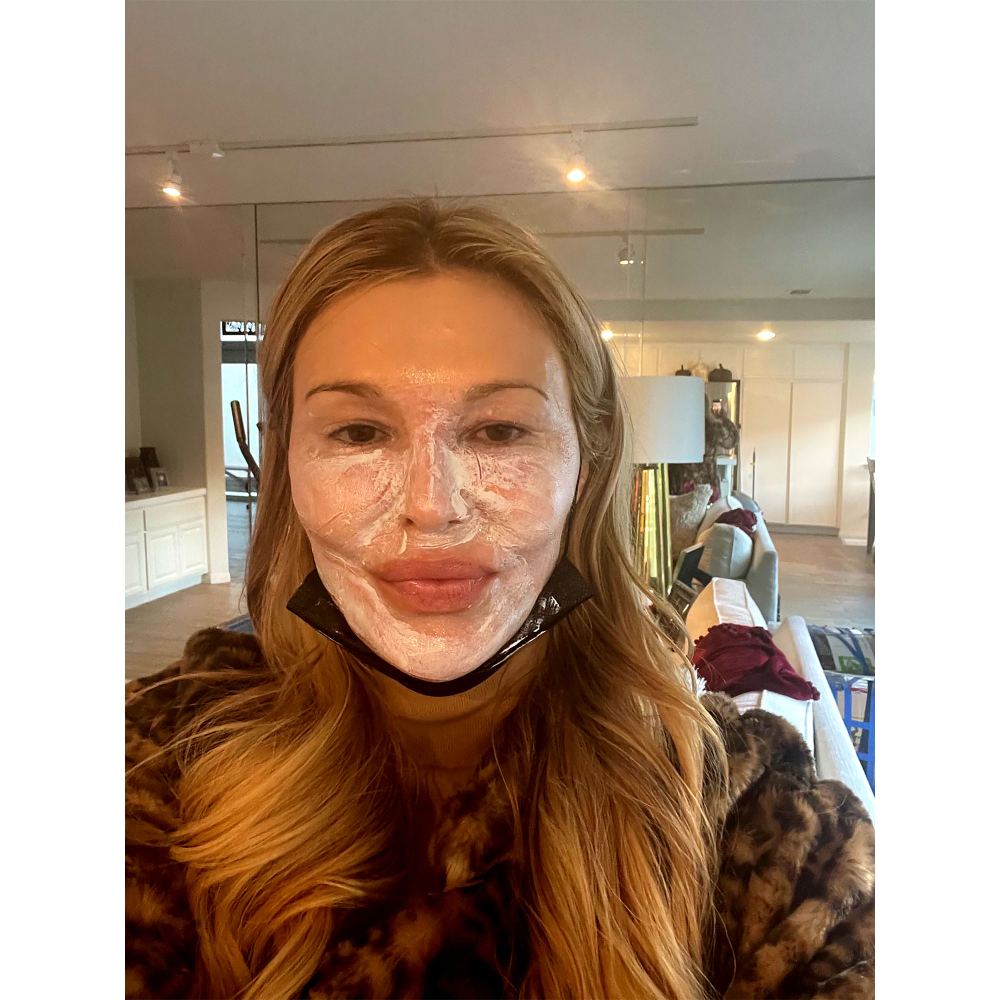 Everything to Know About Brandi Glanville’s ‘Snow Peel’ Treatment