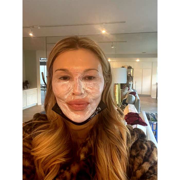 Everything to Know About Brandi Glanville’s ‘Snow Peel’ Treatment