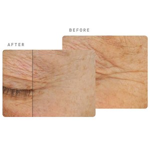 OS-01 Topical Supplement