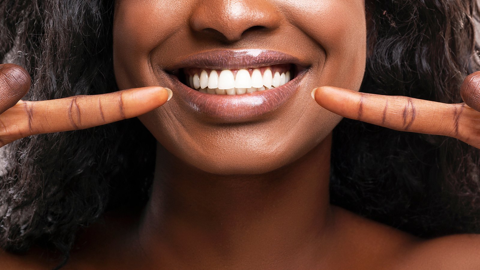 white-teeth-smile-whitening