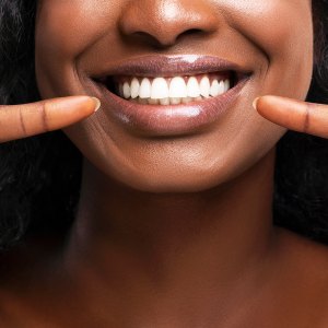 white-teeth-smile-whitening