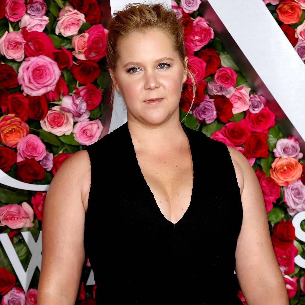 Amy Schumer Dissolves Her Facial Filler: ‘I Looked Like Maleficent’