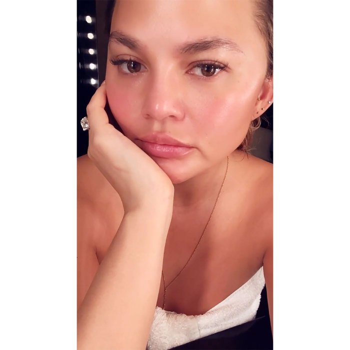 Chrissy Teigen Shares Results of Her Eyebrow Transplant Surgery