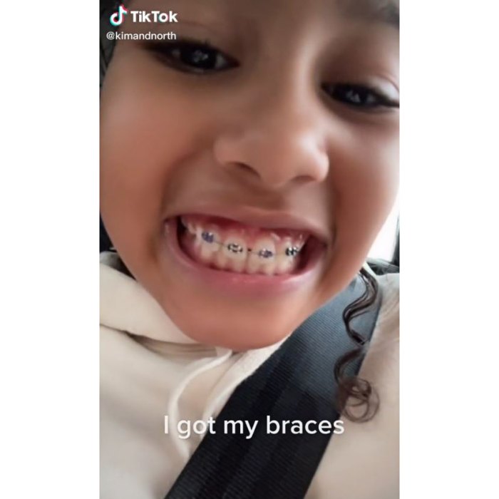 Kim Kardashian North West's daughter, 8, makes her brace debut in adorable TikTok video