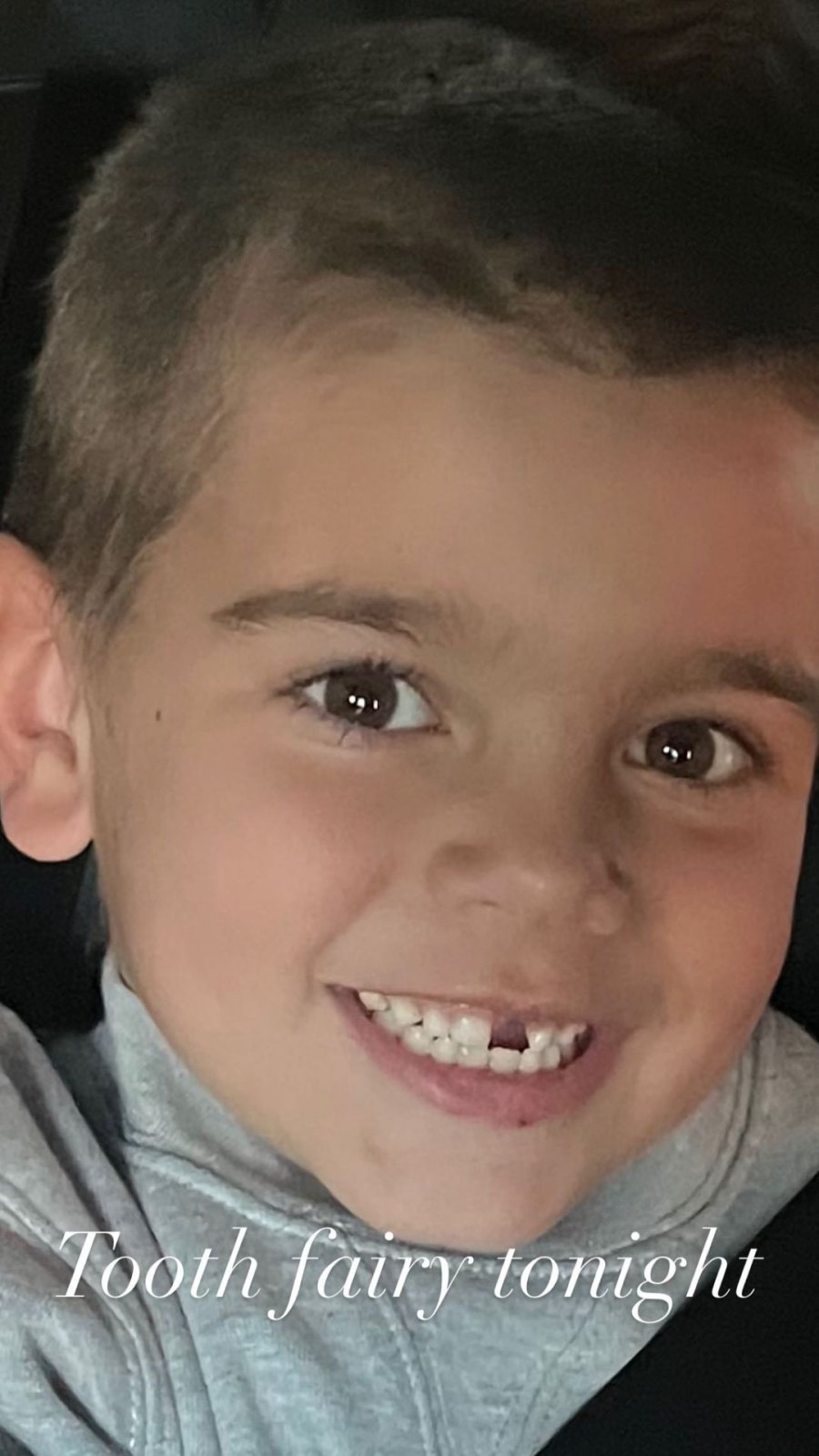 Scott Disick Shows 6-Year-Old Son Reign’s Missing Tooth