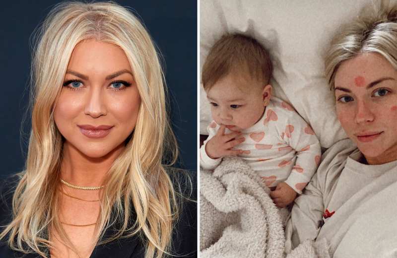 Stassi Schroeder Gets Real About Her ‘Facial Psoriasis’: ‘Out to Play’