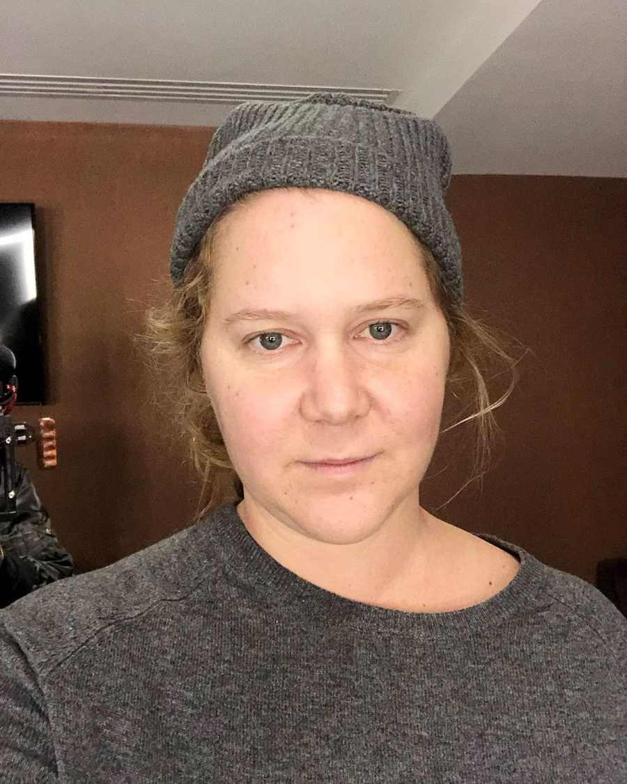 Amy Schumer Gets Real About Experiencing Crushing Anxiety
