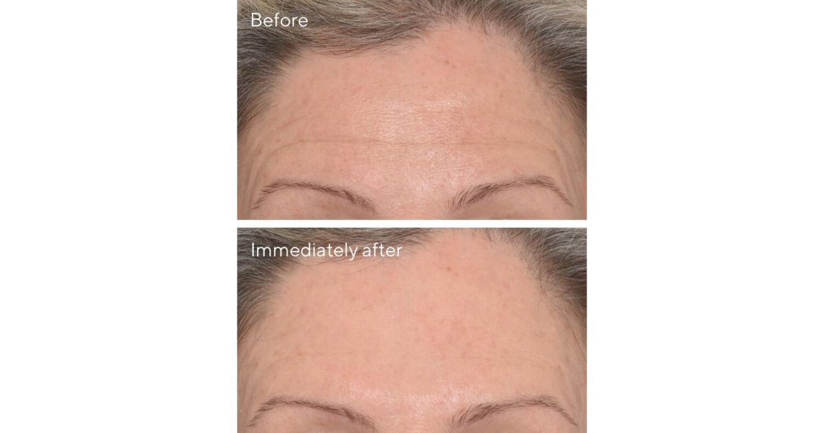 This Murad Wrinkle Corrector Works Like an Instant Filler to Target Fine Lines.jpg