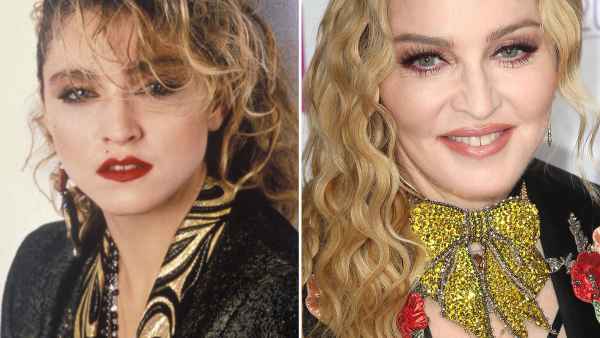 Madonna: How Her Face Has Changed 1984, 2016