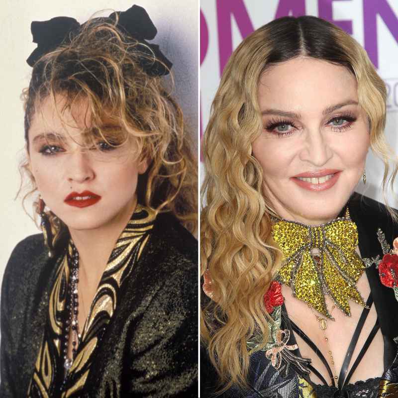 Madonna: How Her Face Has Changed 1984, 2016