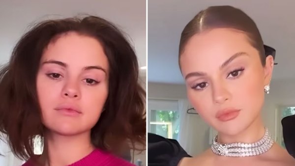 Selena Gomez Shows Off Before After Transformation SAG Awards Watch