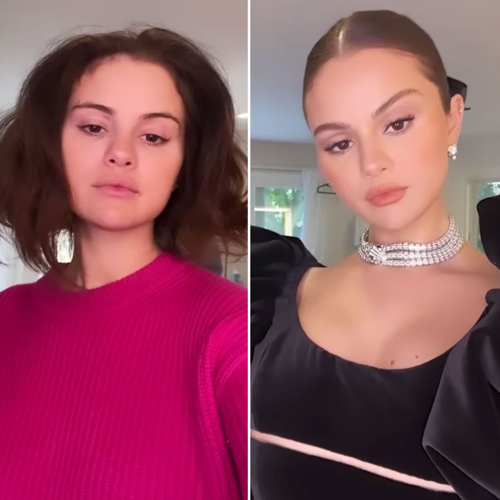 Selena Gomez Shows Off Before After Transformation SAG Awards Watch