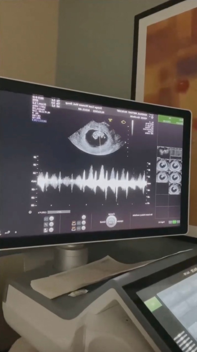 Sneak Peeks! Kellan Lutz and More Stars Show Ultrasound Pics