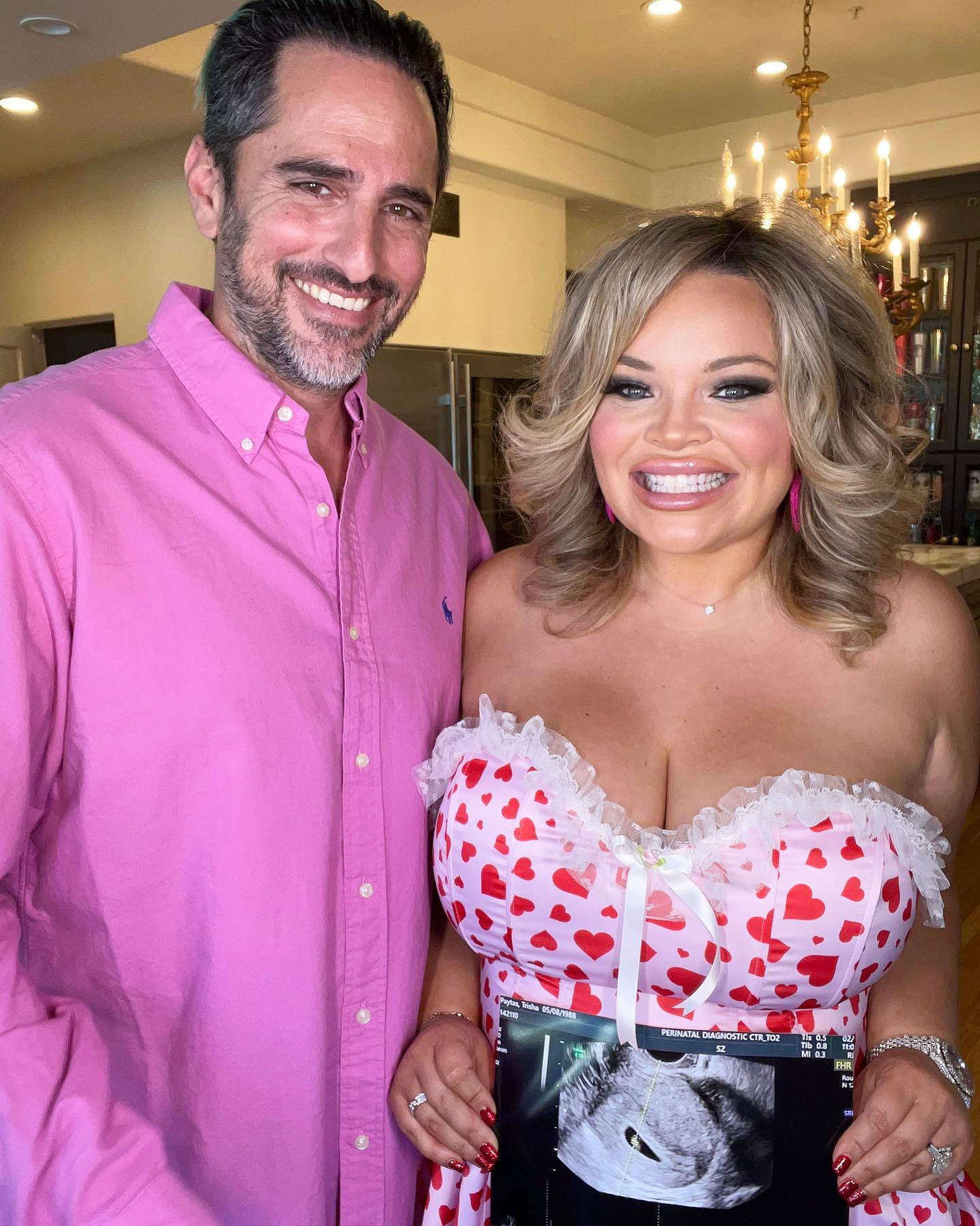 YouTuber Trisha Paytas Is Pregnant, Expecting 1st Baby With Husband photo