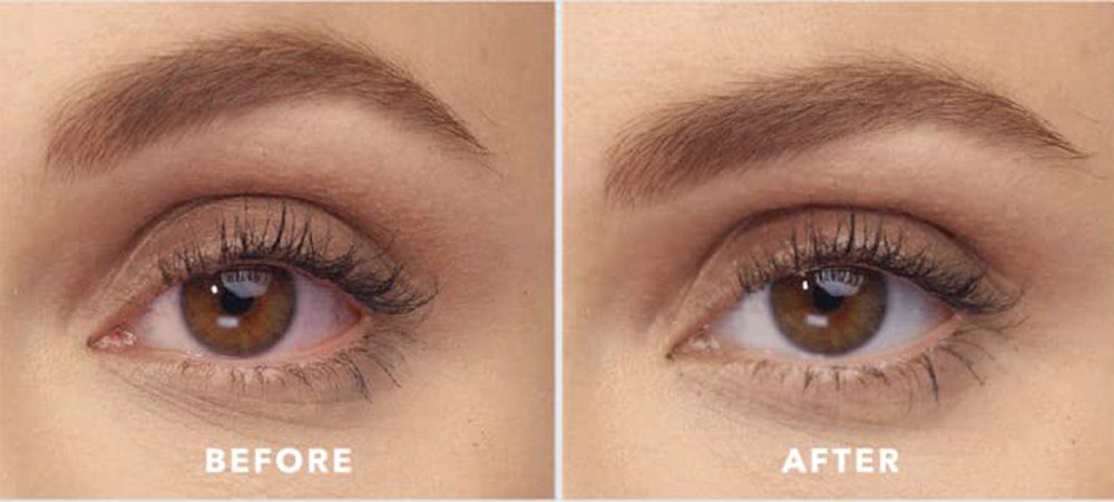 lumify-eye-drops-before-after