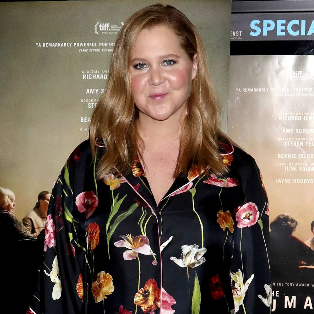 Amy Schumer 'Wanted to Be Real' by Revealing Liposuction Surgery