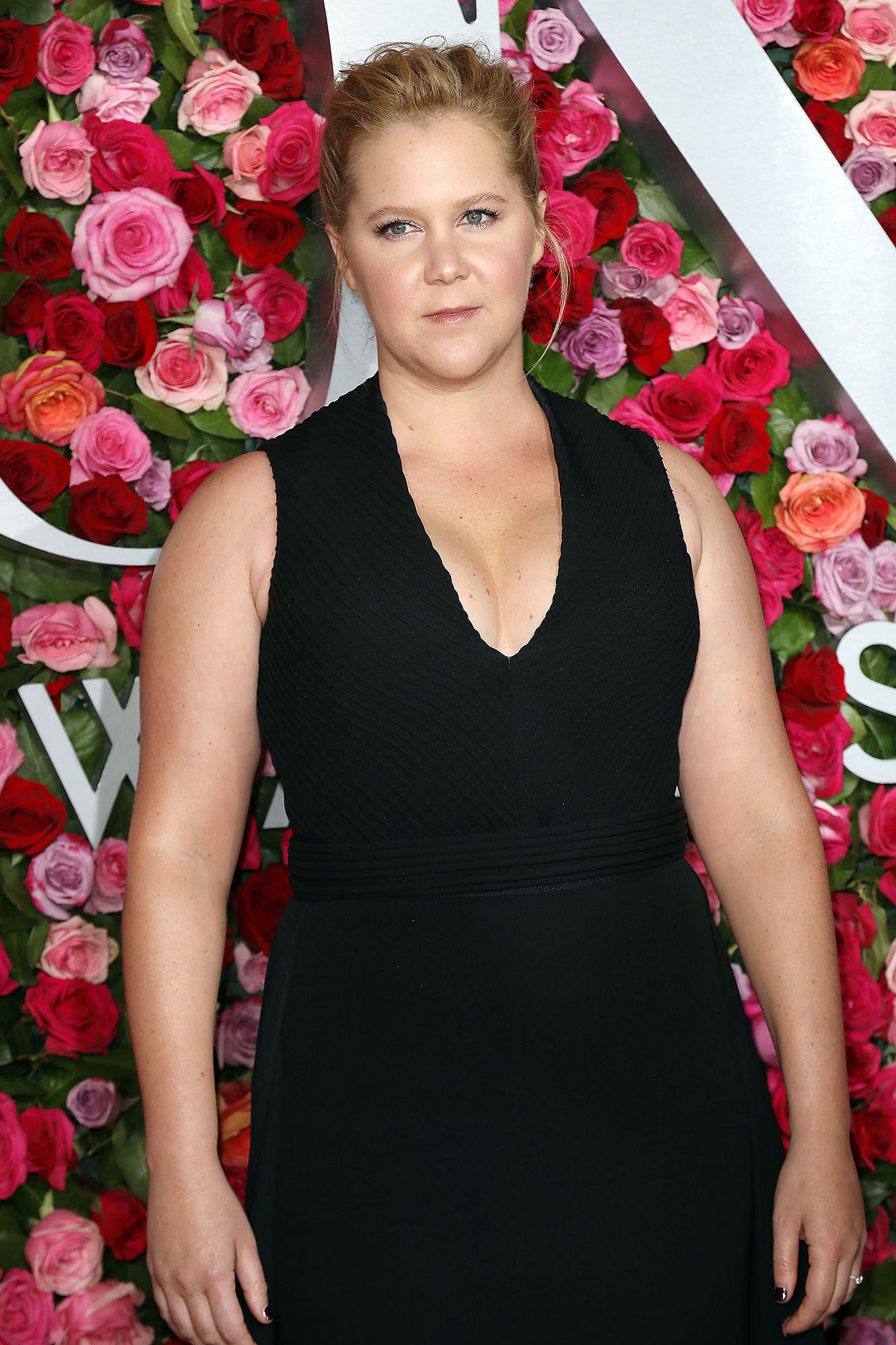 Amy Schumer's Most Honest Quotes About Her Liposuction Surgery | UsWeekly