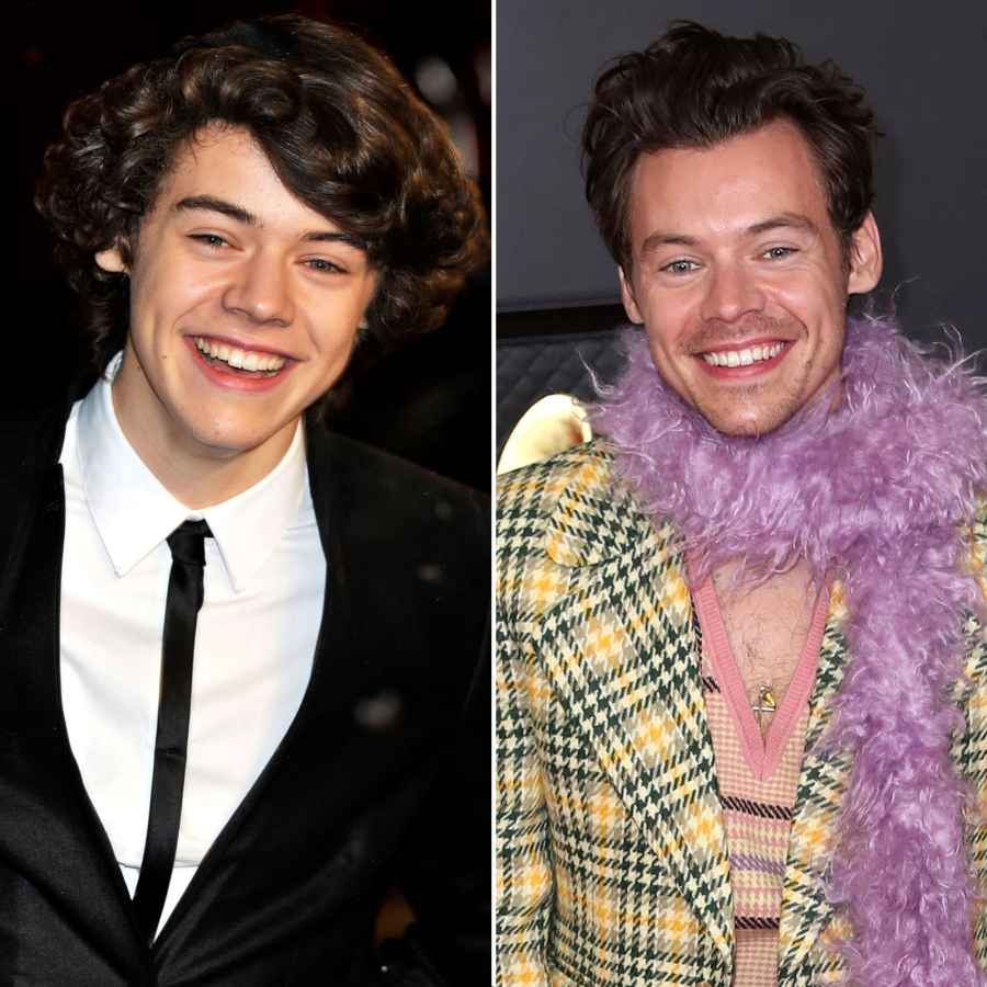 Harry Styles Former One Direction Stars Today