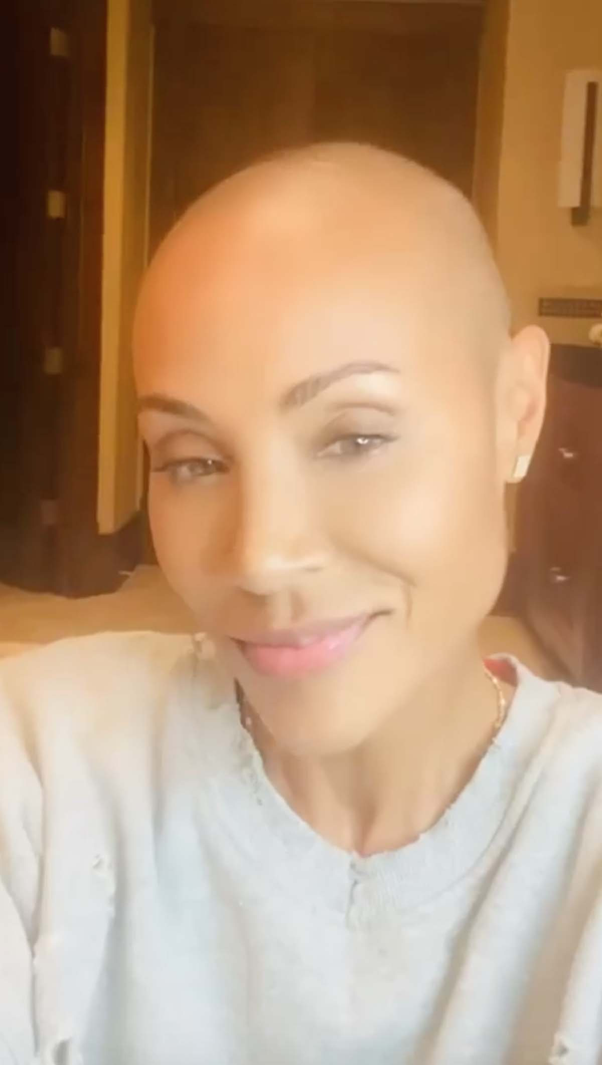 Jada Pinkett Smith's Honest Quotes About Alopecia, Hair Loss