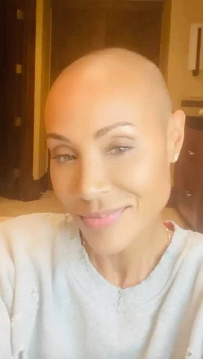 Jada Pinkett Smiths Most Honest Quotes About Alopecia Condition Hair Loss