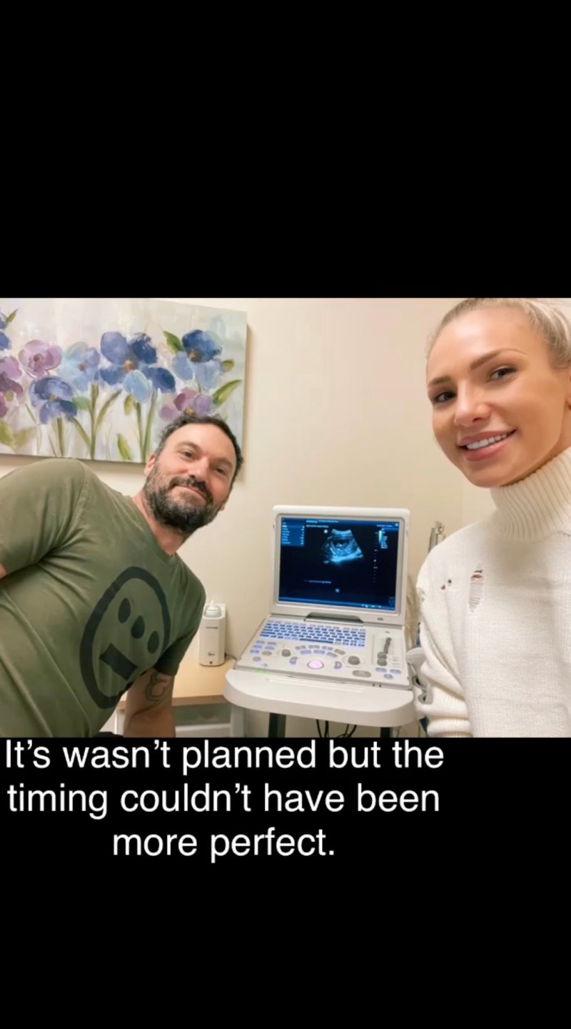 Pregnant Stars Share Ultrasound Pics Sharna Burgess