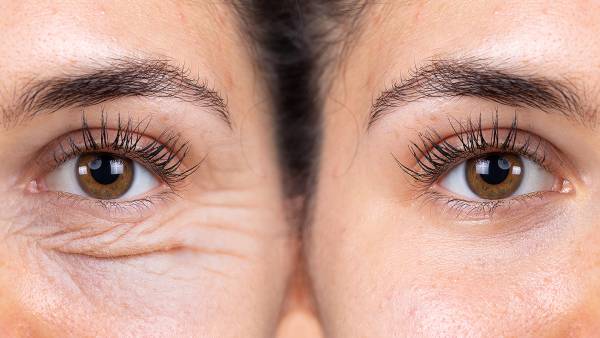 before-after-anti-aging-wrinkle-eye-cream