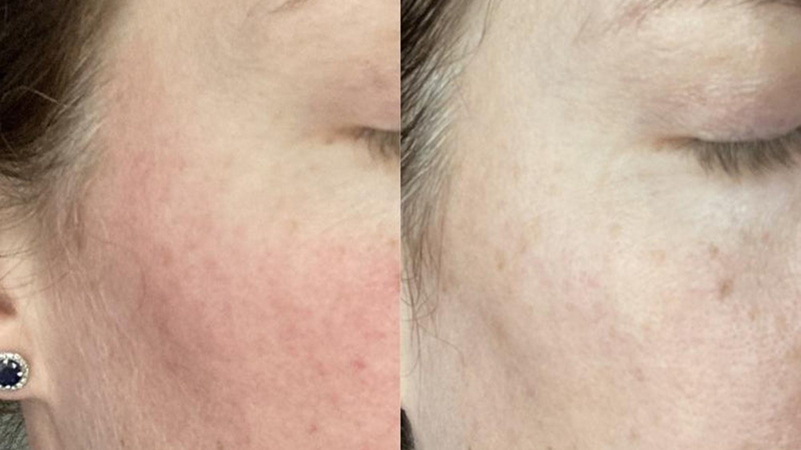 three-ships-lavender-hydrosol-toner-before-after