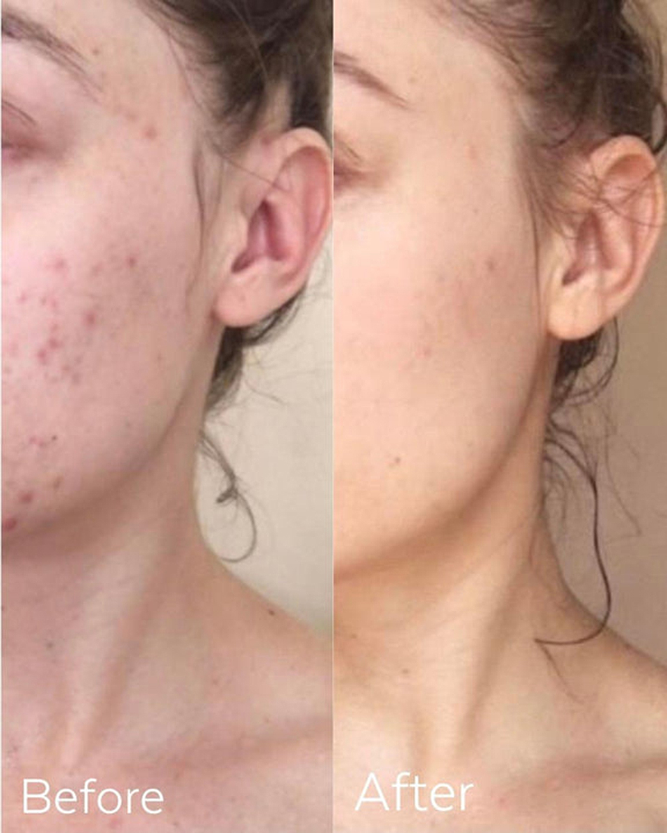 three-ships-purify-cleanser-before-after