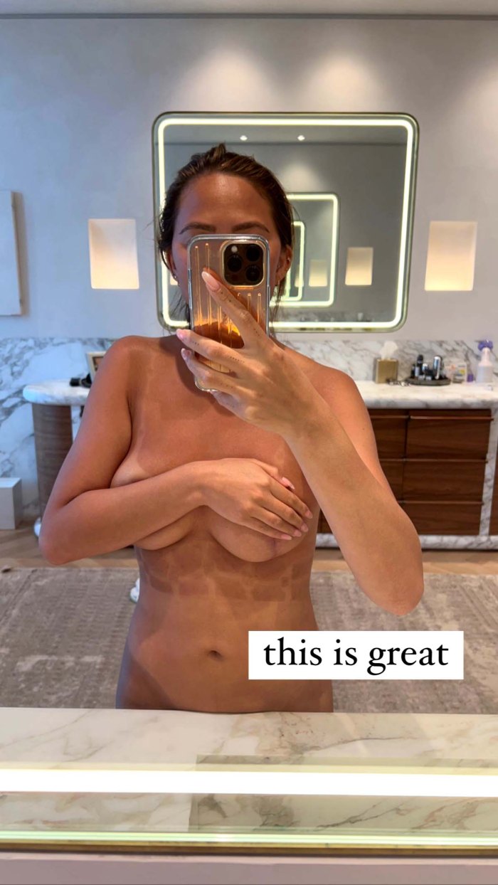 Chrissy Teigen Pokes Fun Hilarious Tan Lines Posing Topless
