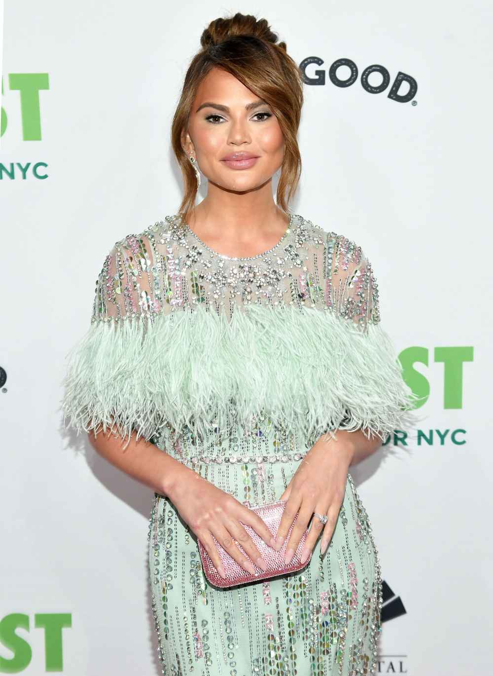 Chrissy Teigen Calls Out Fan Who Claims She Gets Constant Liposuction
