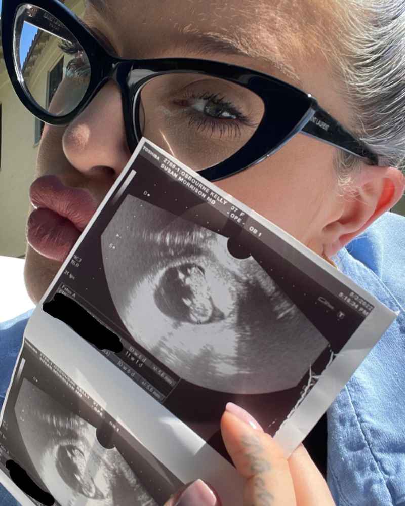 Kelly Osbourne Is Going to Be a ‘Mumma,’ Expecting Her First Child: ‘To Say I’m Happy Does Not Quite Cut It’