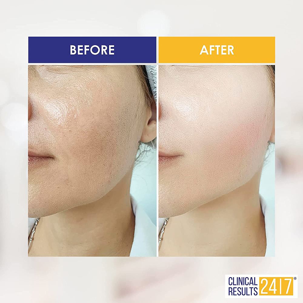 clinical-results-nasa-stem-cell-serum-before-after