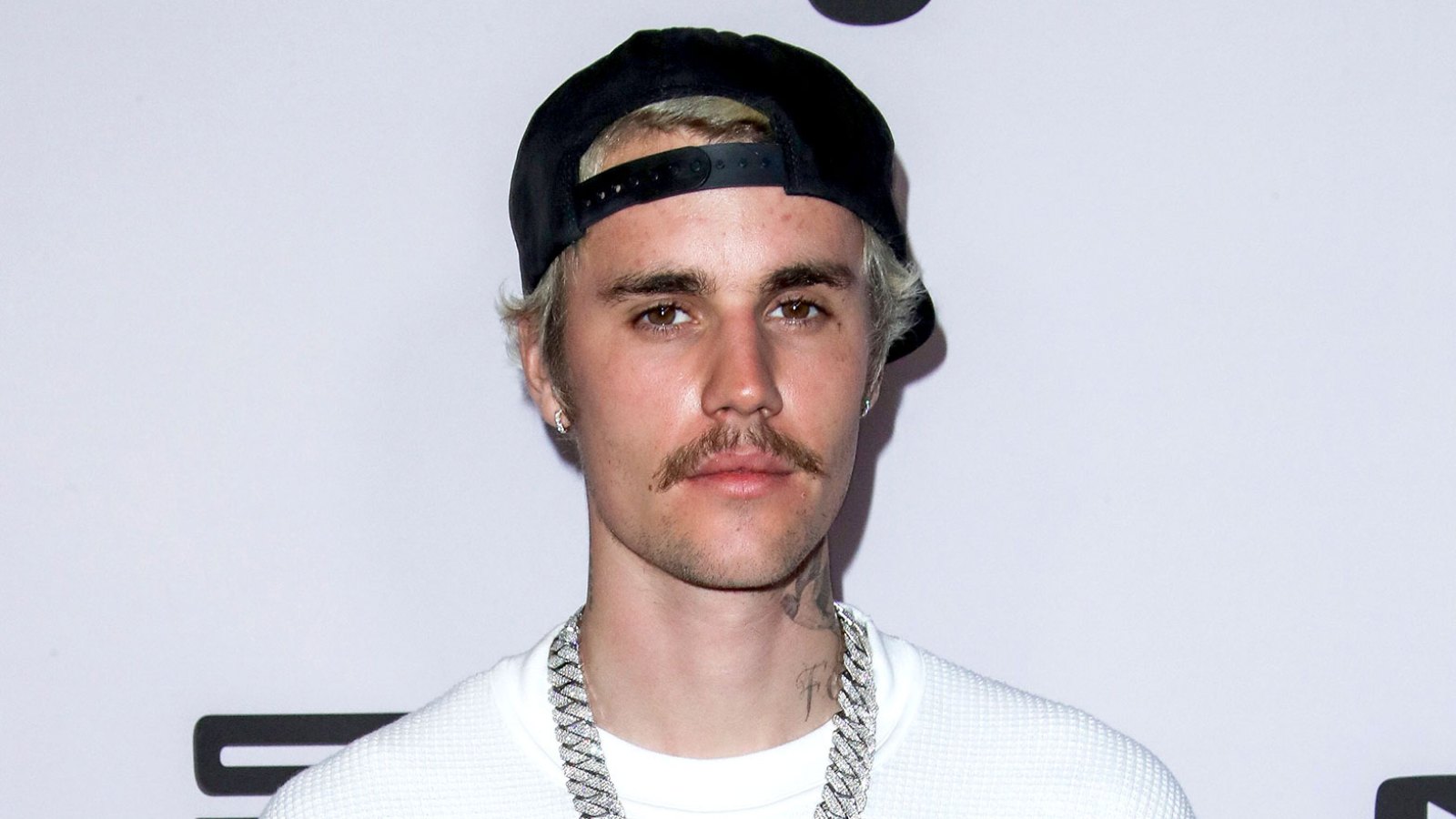Justin Bieber Reveals He’s Suffering From Ramsay Hunt Syndrome Leaving Half His Face Paralyzed