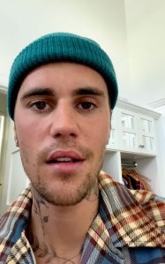 Justin Bieber Reveals He's Suffering From Ramsay Hunt Syndrome, Leaving Half His Face Paralyzed