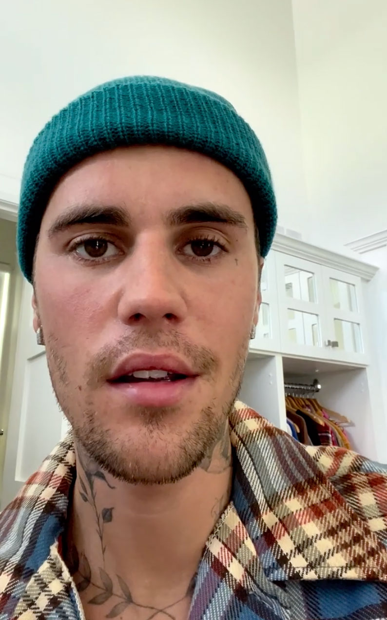 Justin Bieber Reveals He’s Suffering From Ramsay Hunt Syndrome, Leaving Half His Face Paralyzed