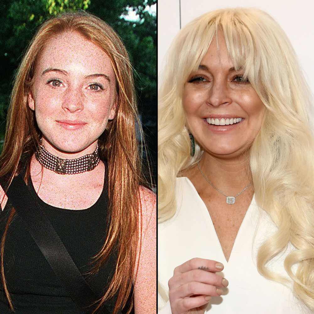 Lindsay Lohan's Face: How It's Changed
