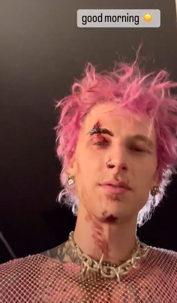 Machine Gun Kelly Shares Graphic Photos of His Bloodied Head