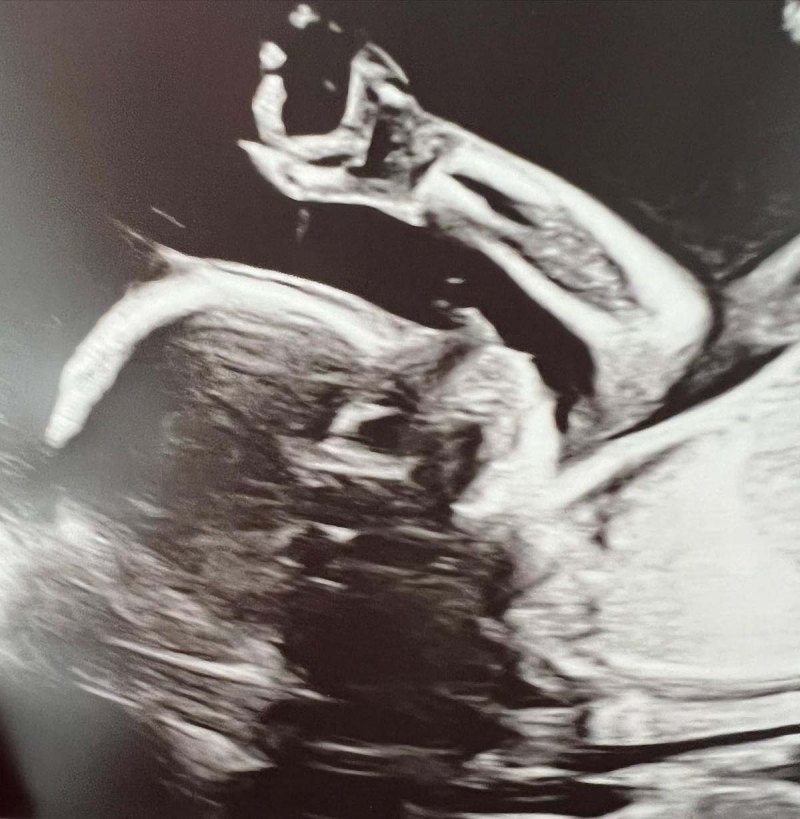 Sneak Peeks Hilaria Baldwin More Pregnant Stars Show Ultrasound Pics