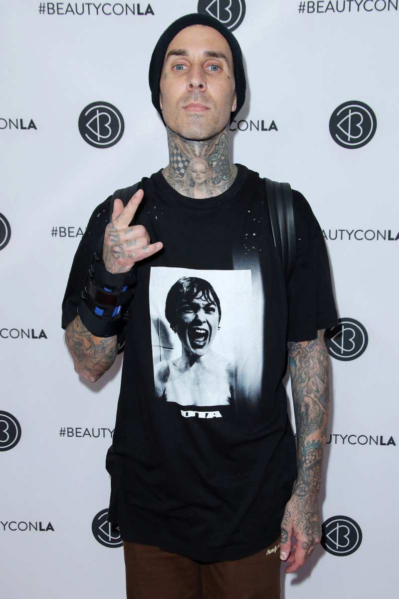 Travis Barker’s Health Ups and Downs Through the Years