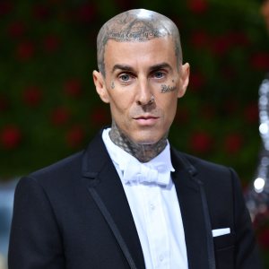 Travis Barker’s Health Ups and Downs Through the Years