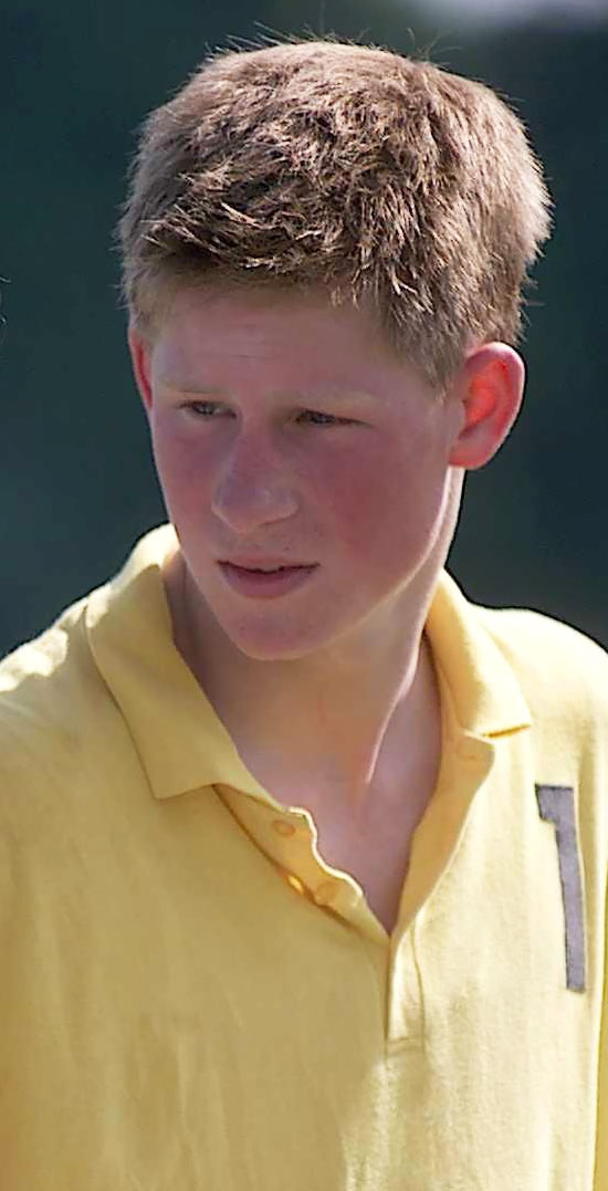 Prince Harry’s Nude Photo Scandal: His 5 Most Outrageous Moments yellow polo shirt 2001